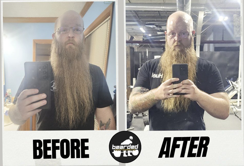 Johnny Custer before and after transformation